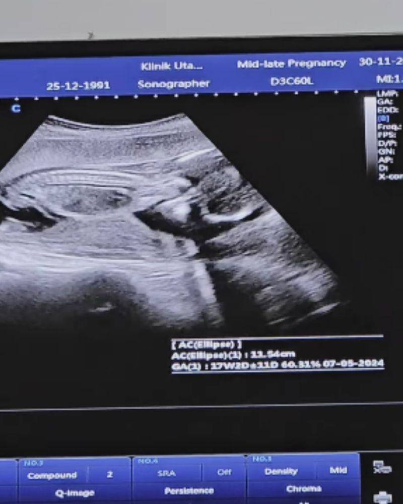 Instagram.com/@ichasoebandono